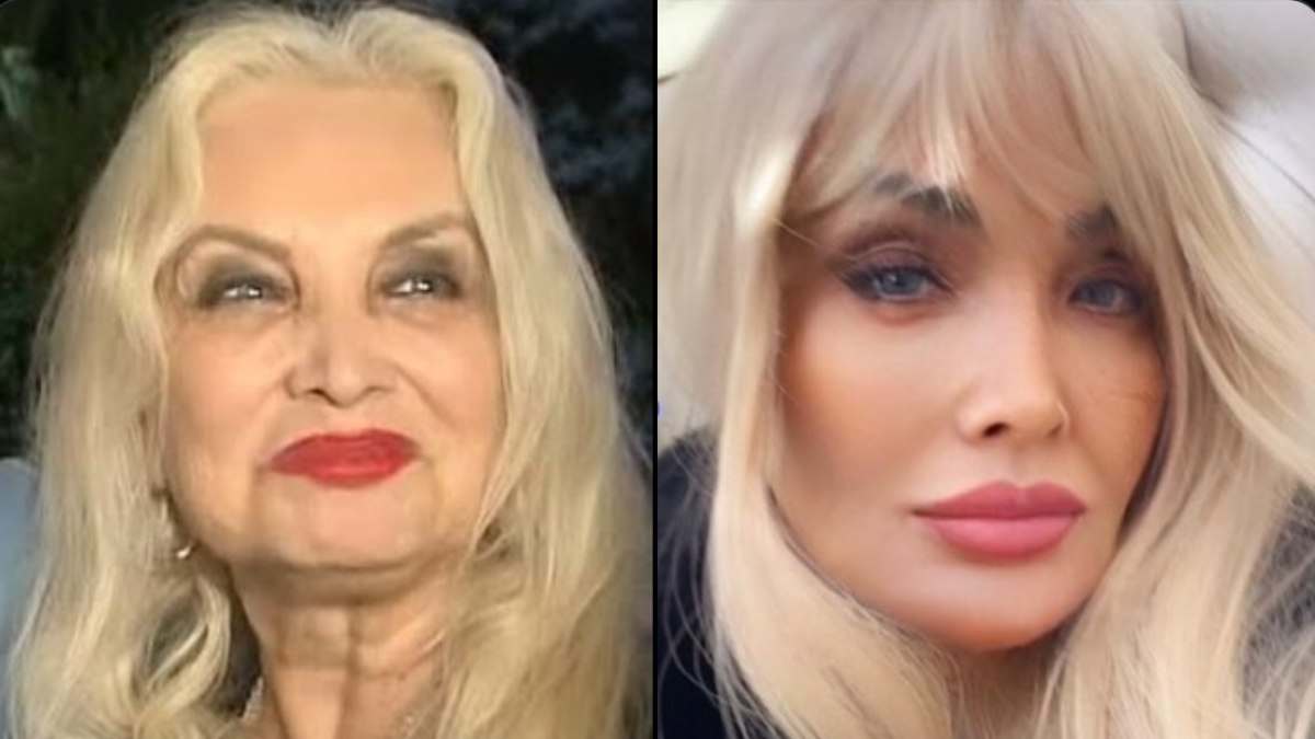 Orhan Gencebay’ın hayat arkadaşı Sevim Emre’den filtre iddialarına cevap verdi: “Meyve veren ağaç taşlanır”